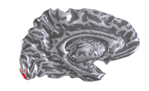 Scan of brain - visual cortex area illuminated at bottom left
